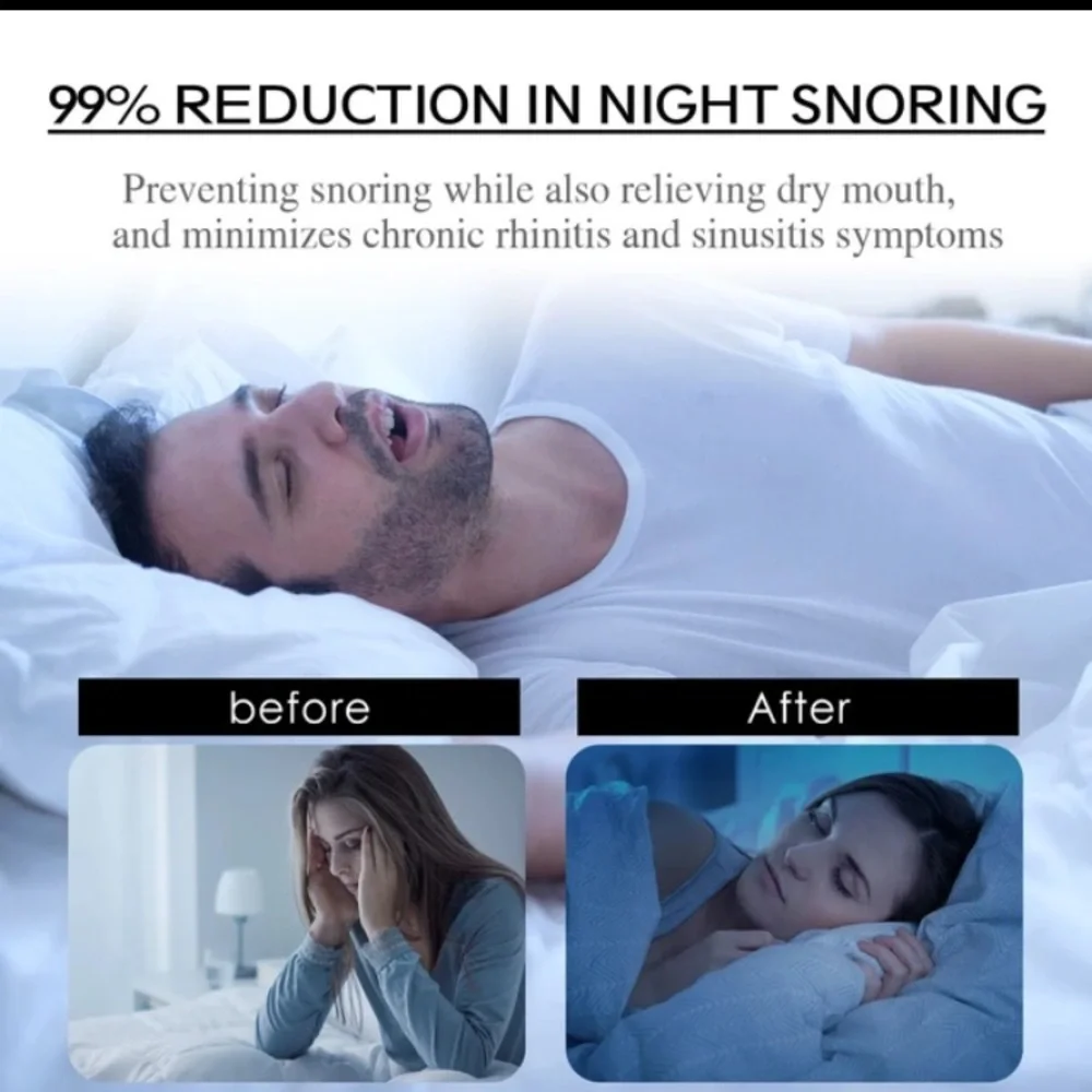 6 month supply Mouth Tape Dry Mouth Relief Stop Snoring Stickers Hypoallergenic